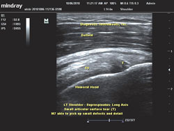 Ultrasound Results